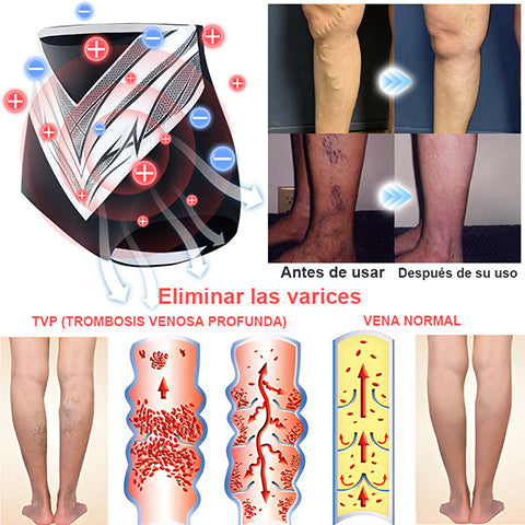 Pantalones cortos moldeadores de turmalina y fibra de titanio de grado médico Anyidea™ con autocalentamiento🔥🔥🔥🔥
