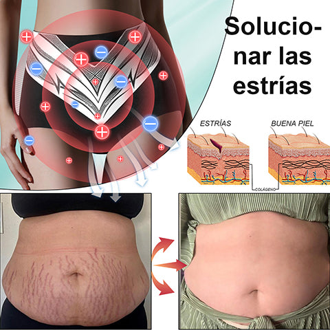 Pantalones cortos moldeadores de turmalina y fibra de titanio de grado médico Anyidea™ con autocalentamiento🔥🔥🔥🔥
