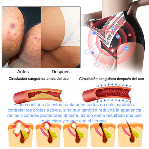 Pantalones cortos moldeadores de turmalina y fibra de titanio de grado médico Anyidea™ con autocalentamiento🔥🔥🔥🔥
