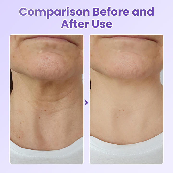 Jorondy® NeckYouth Peptide Anti-Wrinkle Patch