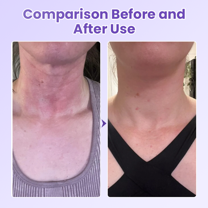 Jorondy® NeckYouth Peptide Anti-Wrinkle Patch
