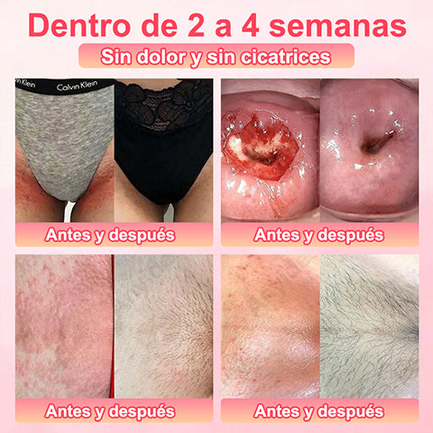 Pantalones cortos moldeadores de turmalina y fibra de titanio de grado médico Anyidea™ con autocalentamiento🔥🔥🔥🔥