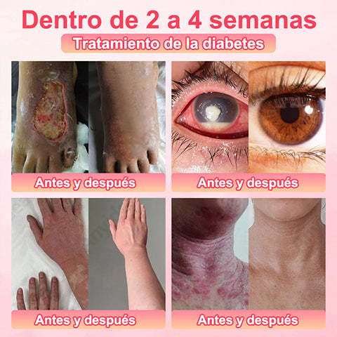 Pantalones cortos moldeadores de turmalina y fibra de titanio de grado médico Anyidea™ con autocalentamiento🔥🔥🔥🔥