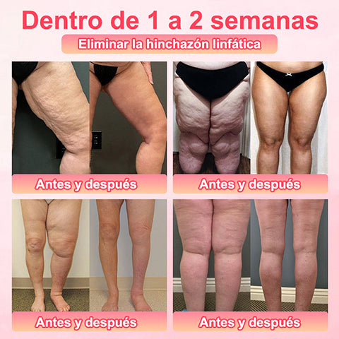 Pantalones cortos moldeadores de turmalina y fibra de titanio de grado médico Anyidea™ con autocalentamiento🔥🔥🔥🔥