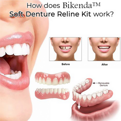 Bikenda™ Comfort Soft Denture Reline Kit
