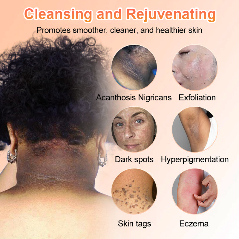 Purifying Exfoliating Gel for Acanthosis Nigricans, Exfoliation, Dark Spots, Skin Tags, and Eczema 🍊
