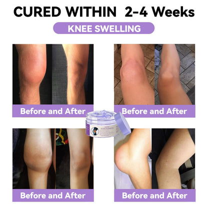 ADFIRE™ 7 Day Rapid Joint & Bone Therapy Cream USA Orthopedics (AAOS) Approved
