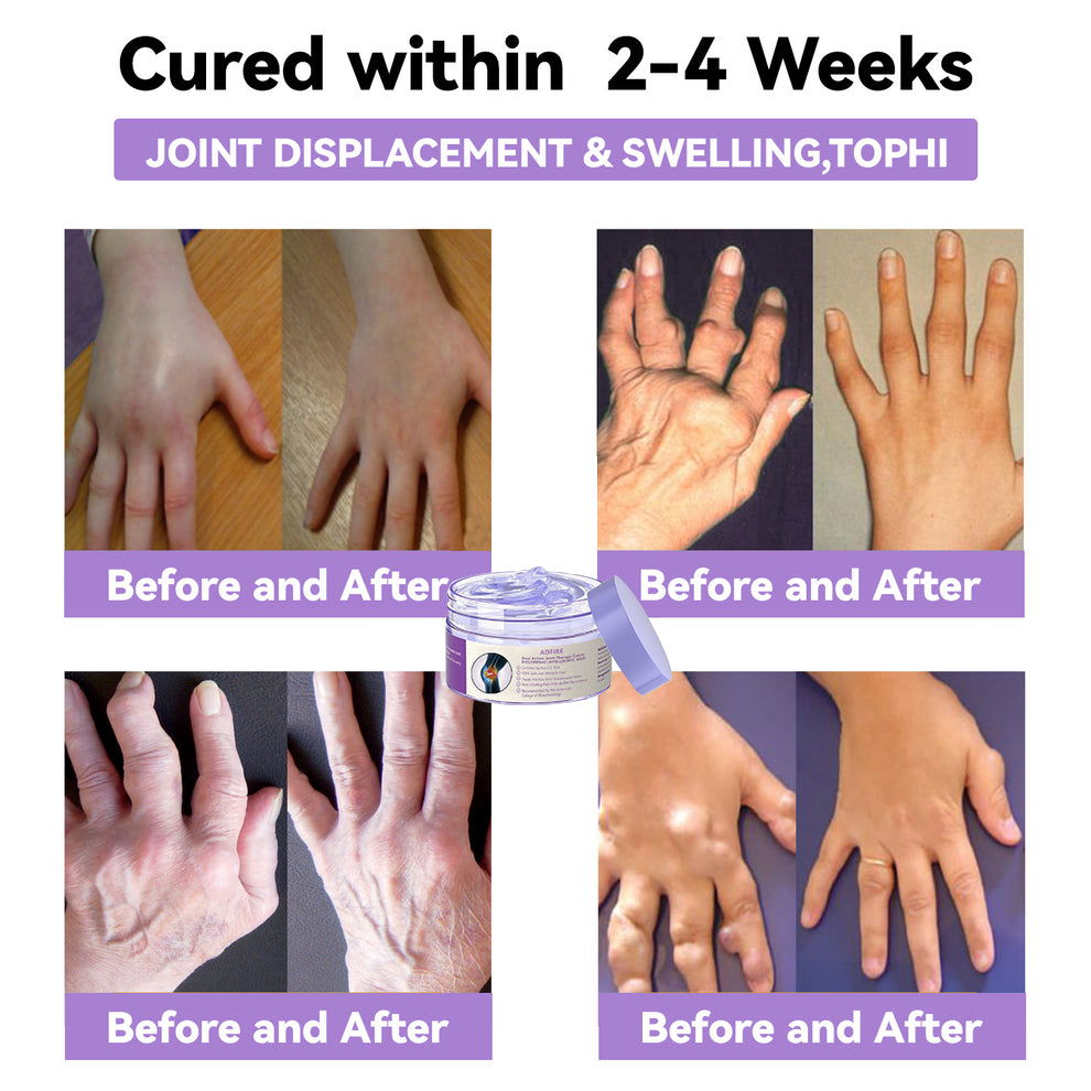 ADFIRE™ 7 Day Rapid Joint & Bone Therapy Cream USA Orthopedics (AAOS) Approved