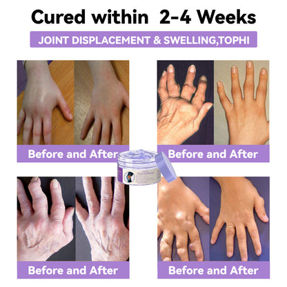 ADFIRE™ 7 Day Rapid Joint & Bone Therapy Cream USA Orthopedics (AAOS) Approved