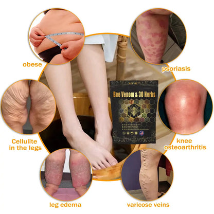 Last day to get 70% OFF: ADFIRE™  Bee Venom & 30-Herb Detox Foot Soak Beads for Body Sculpting- Recommended by the America Lymphatic Academy (ALA) 🧀