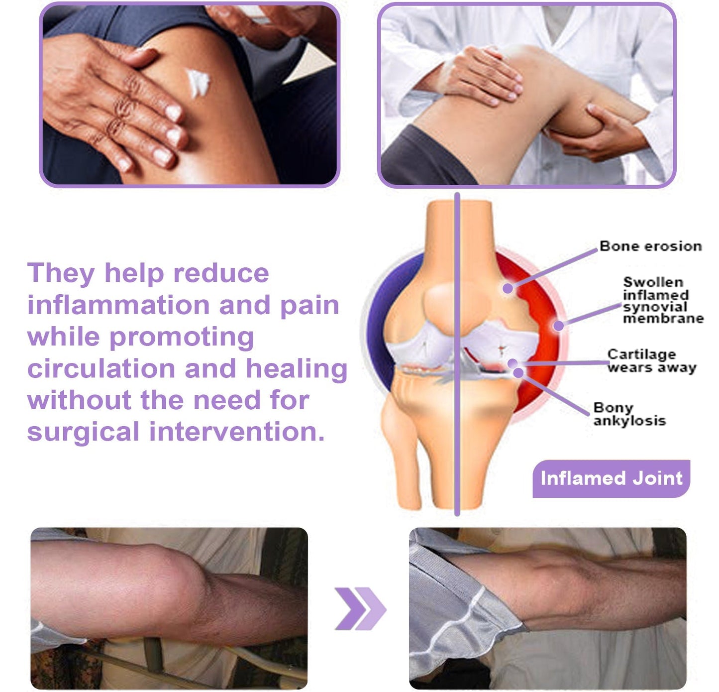 ADFIRE™ 7 Day Rapid Joint & Bone Therapy Cream USA Orthopedics (AAOS) Approved