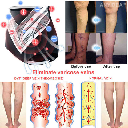 Medical Grade Titanium Fiber Self-heating Tourmaline Shaping Shorts✨