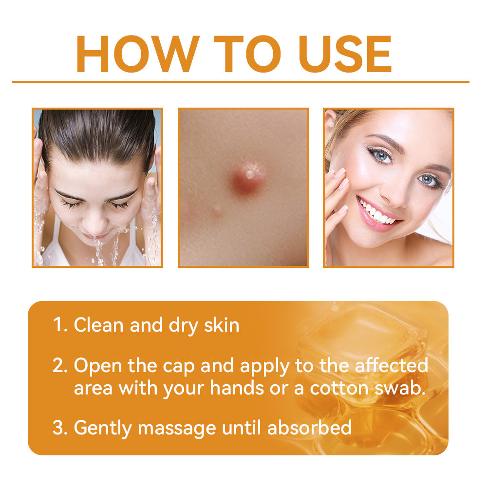 Turonu™ Bee Venom Treatment Cream 👩🏼‍⚕️（FDA Approved） (🔥𝑳𝒂𝒔𝒕 𝒅𝒂𝒚 𝒑𝒓𝒐𝒎𝒐𝒕𝒊𝒐𝒏 95% 𝒐𝒇𝒇)