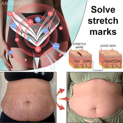 Medical Grade Titanium Fiber Self-heating Tourmaline Shaping Shorts✨