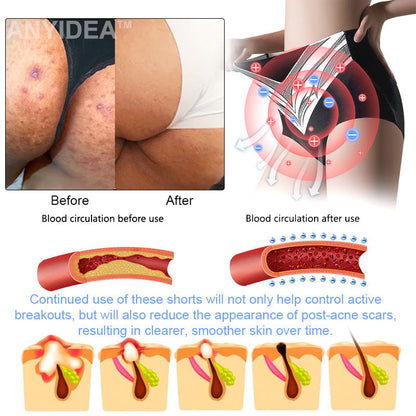 Medical Grade Titanium Fiber Self-heating Tourmaline Shaping Shorts✨