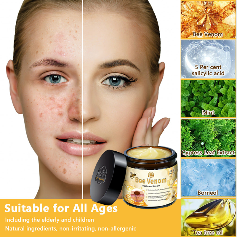 Turonu™ Bee Venom Treatment Cream 👩🏼‍⚕️（FDA Approved） (🔥𝑳𝒂𝒔𝒕 𝒅𝒂𝒚 𝒑𝒓𝒐𝒎𝒐𝒕𝒊𝒐𝒏 95% 𝒐𝒇𝒇)