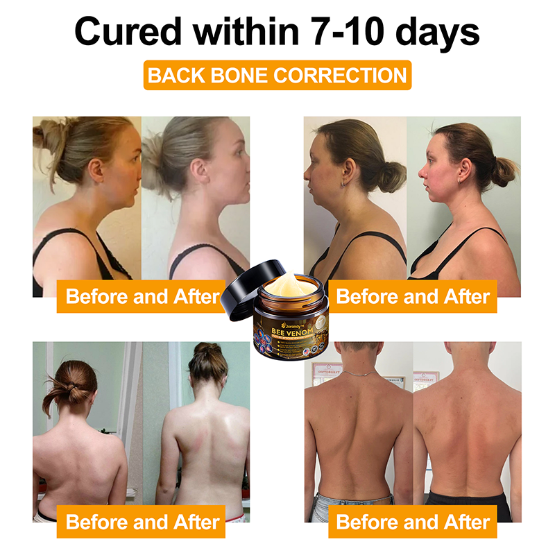 Official Store:  🦵Jorondy™ Bee Venom Arthritis Therapy Cream(Specially for older adults & AAOS recommends)🔥𝑳𝒂𝒔𝒕 𝒅𝒂𝒚 𝒑𝒓𝒐𝒎𝒐𝒕𝒊𝒐𝒏 8𝟎% 𝒐𝒇𝒇