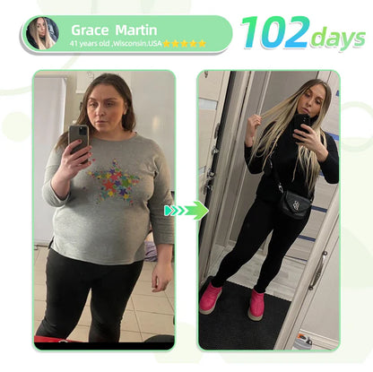 See results in 7 days🌲Jorondy™ SMGT-GLP-1 Nano Microneedle Patch（Painless, long-lasting, addressing diabetes, obesity, and cardiovascular diseases）