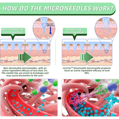 See results in 7 days🌲Jorondy™ SMGT-GLP-1 Nano Microneedle Patch（Painless, long-lasting, addressing diabetes, obesity, and cardiovascular diseases）