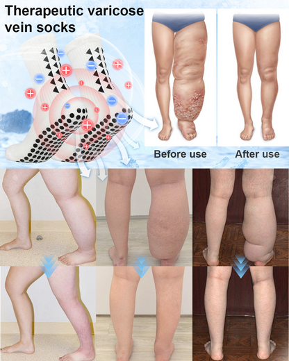 ANYIDEA™ Tourmaline Magnetic Therapy Socks (LAST DAY SALE-95% OFF)