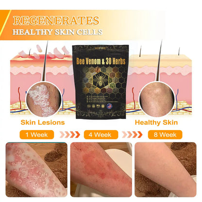 Last day to get 70% OFF: ADFIRE™  Bee Venom & 30-Herb Detox Foot Soak Beads for Body Sculpting- Recommended by the America Lymphatic Academy (ALA) 🧀