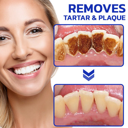 🌿TLOPA™ Focussmile Bee Venom Treatment Oral Powder 🦷 (🇺🇸 USA Recommended)