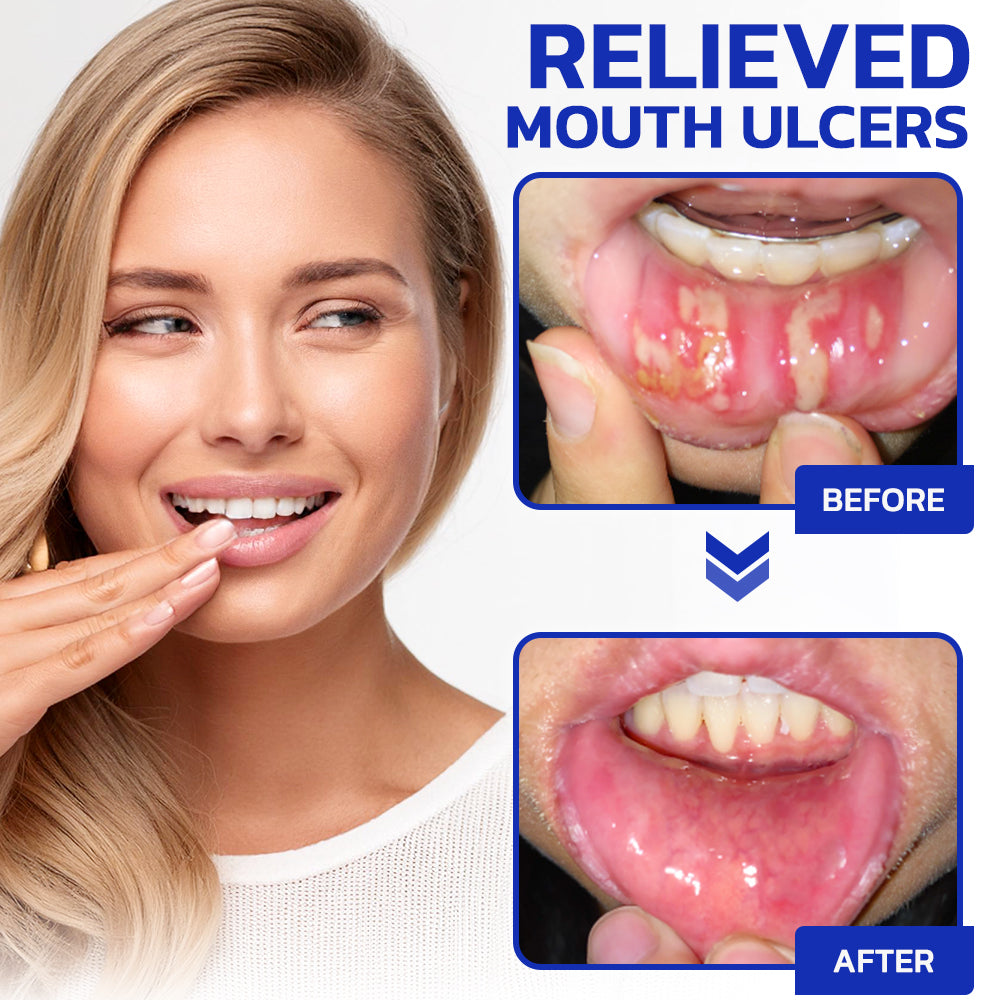 🌿TLOPA™ Focussmile Bee Venom Treatment Oral Powder 🦷 (🇺🇸 USA Recommended)