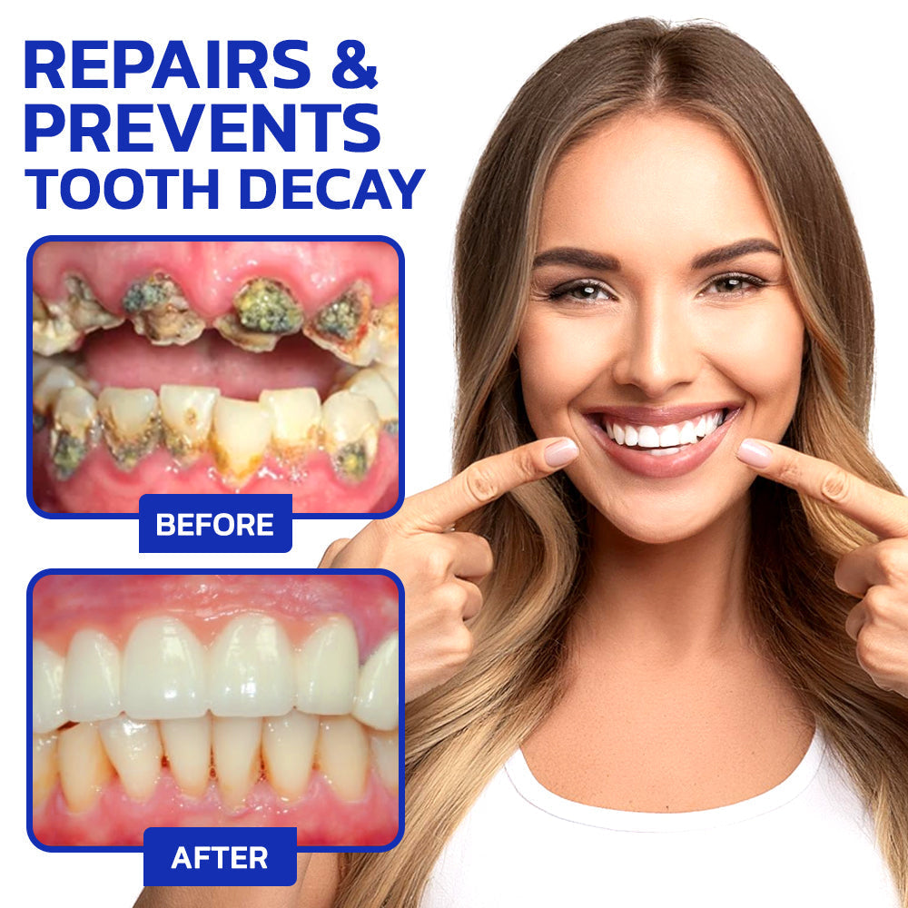 🌿TLOPA™ Focussmile Bee Venom Treatment Oral Powder 🦷 (🇺🇸 USA Recommended)