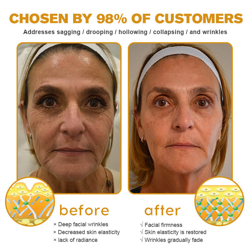 👨‍⚕️💐Made and Shipped from the USA✅ Jorondy™ Botox Bee Venom Wrinkle Removal Cream-Last Day Promotion 70% OFF