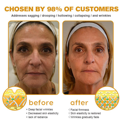 👨‍⚕️💐Made and Shipped from the USA✅ Jorondy™ Botox Bee Venom Wrinkle Removal Cream-Last Day Promotion 70% OFF